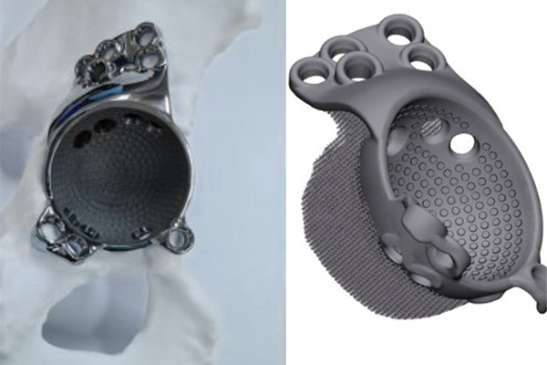 Healthcare--Custom-prosthetics-and-surgical-tools